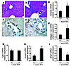 Ptc mice with increased Hh activity exhibit increased EMT after BDL.