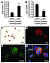 Cholangiocyte populations undergoing EMT during biliary fibrosis in rats ar