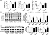 CaMKIIδ deletion does not prevent cardiac hypertrophy induced by 2-week TAC