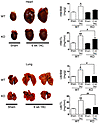 CaMKIIδ deletion reduces relative HW and lung edema in response to 6-week T