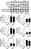 CaMKIIδ deletion normalizes the expression of Ca2+ regulatory proteins and