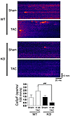 CaMKIIδ ablation reduces SR Ca2+ leak in 6-week TAC mice.