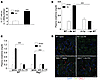 IL-17A produced from non-T and non-B bone marrow–derived cells contributes