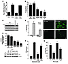 Induction of Fas and apoptosis by ER stress involves CaMKII.