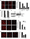 Release of mitochondrial cytochrome c and Δψm in cholesterol-loaded macroph