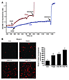 ER stress in macrophages leads to the accumulation of calcium in the mitoch