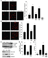 ER stress–induced mitochondrial calcium uptake is dependent on CaMKII.