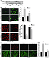 Importance of CaMKIIγ in macrophage apoptosis and Δψm in ER-stressed mice.