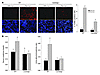 Importance of CaMKIIγ in renal tubular epithelial cell apoptosis and renal