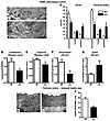 SMCs of Mir143/145-KO mice show a shift from a contractile to a synthetic p