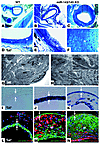 Mir143/145-KO mice develop neointimal lesions.