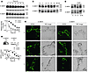 Accelerated internalization and degradation of cell surface HERG protein is