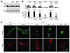 Effects of proteasomal or lysosomal inhibition on 0 mM K+ exposure-induced