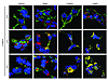 Localization of HERG channels with endocytic degradation pathway markers cl