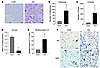 Gonadal WAT in knockout mice has characteristics of brown fat.