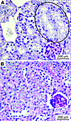 Histology of AKI in a clinically relevant model of CLP-induced sepsis.