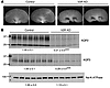 Distension of the renal pelvis and reduced renal AQP2 and AQP3 expression l