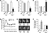 Effects of prolonged treatment of V2R-KO mice with ONO on urine output, wat