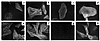 The effect of retroviral and adenoviral expression of kinase-inactive (KI)