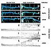 Representative images of mouse aortic luminal surface (top) and aorta arch