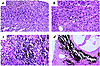 Myocardial histology in α-MHC403/403 mice. (a) Normal cardiac structure at