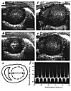 Two-dimensional images obtained by 45-MHz echocardiography demonstrating th