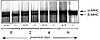 Silver-stained 6% SDS-polyacrylamide gel showing cardiac MHC isoforms at po