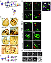 Tsc and Rheb regulate Notch-dependent cell-fate decisions in Drosophila.