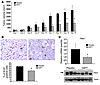 DAPT suppresses growth, proliferation, and Notch pathway activation in Tsc2