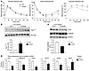 ChREBP-induced steatosis is not associated with insulin resistance.