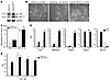 Increased ARfl activity in LNCaP cells transfected with ARv567es.