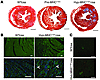 Hypertrophic α-MHC719/+ mice have cardiac hypertrophy, increased myocardial