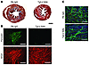 Tgf-β NAb attenuated cardiac fibrosis, reduced periostin expression, and di