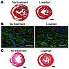 Losartan attenuated cardiac fibrosis, reduced periostin expression, and dim