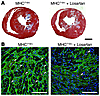 Losartan did not reverse fibrotic remodeling in established HCM but diminis