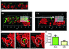 Role of PSMβ peptides in S. epidermidis biofilm development: cell detachmen