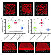 Role of PSMβ peptides and agr in S. epidermidis biofilm development: channe