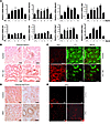 Increased expression of Notch pathway in kidneys of mouse models of TIF and