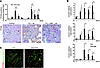 TEC expression of Notch correlates with cell proliferation in vivo in mice