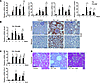 Pharmacological inhibition of Notch signaling ameliorates FA-induced TIF.