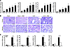 Pharmacological inhibition of Notch signaling ameliorates UUO-induced TIF.