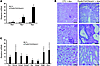 Transgenic expression of ICNotch1 in TECs causes severe kidney fibrosis.