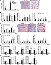 In vivo expression of Notch does not correlate with markers of EMT.