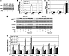 Overexpression of a dominant-negative IKKβ prevents ceramide accrual and LP