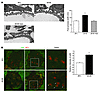 mTORC1 activation in podocytes, and prevention of podocyte morphological ch