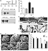 PcKOTsc1 mice show proteinuria and podocyte loss.