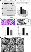 Rapamycin reverses established phenotypes in PcKOTsc1 mice.