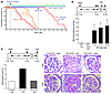 mTORC1 activation in podocytes causes proteinuria and mesangial expansion i