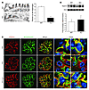 Hyperactivation of mTORC1 leads to mislocalization of slit diaphragm protei