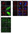 Mislocalization of nephrin by abnormal mTORC1 activation and diabetes.